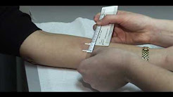 TB Skin Test - Mantoux Method