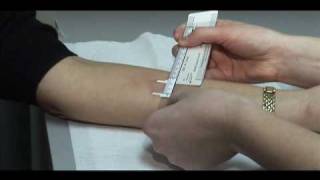 Matematisk dråbe fumle TB Skin Test - Mantoux Method - YouTube
