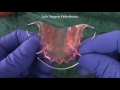 Care of Orthodontic Retainers