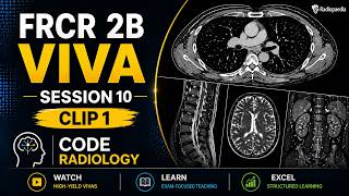 Code Radiology Session 10 Clip 1 - Radiology FRCR 2B Mock Viva and Radiology Interesting Cases