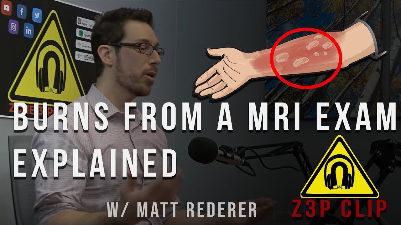 Z3P Clips MRI Burns? YouTube