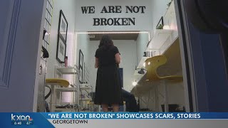 Women show off scars in photo project to challenge stigma