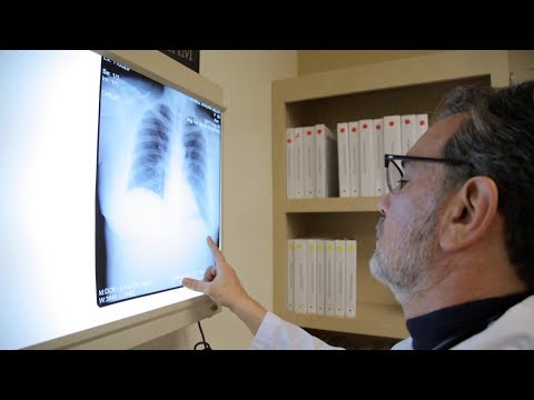 Maladies du poumon causées par le tabac: 1re partie du programme spécial pour la journée sans tabac Maladies du poumon causées par le tabac: 1re partie du programme spécial pour la journée sans tabac