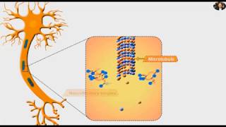 Neurofibrillary tangles and Tau protein (Alzheimer) Resimi