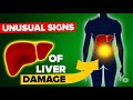 LIVER is DYING! Weird Signs of LIVER DAMAGE | Tips to improve | Mind Folio Hub