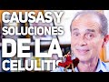 Episodio #2022 Causas Y Soluciones De La Celulitis