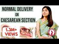 Normal Delivery Or Caesarean Section | Dr Anjali Kumar | Maitri