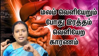 மலம் வெளியேறும் போது இரத்தம் வர காரணம் |Dr.Rajalakshmi |TCH