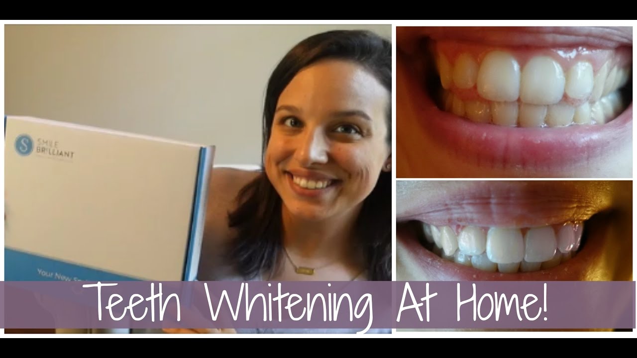 At Home Whitening for Coffee Lovers! Smile Brilliant Teeth Whitening
