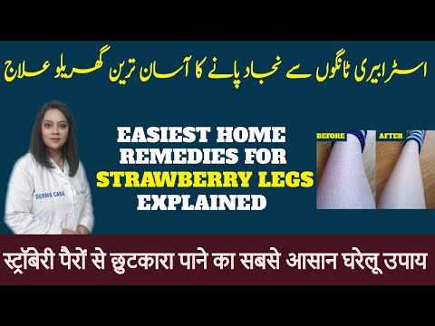Come sbarazzarsi di Gambe fragola a casa | Dr. Batool Ashraf