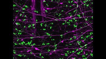 Sea anemone neurons and stinging cells showing their dynamic processes