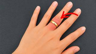 JUST 1 MINUTE 😱 How to remove a stuck ring without breaking or injuring your finger!