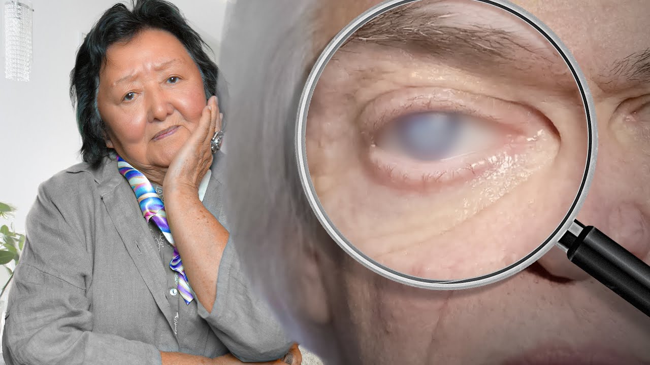 Тайна Блеска Глаз: Почему Женщины Его Теряют