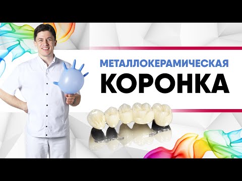 Металлокерамическая #коронка на зуб. Плюсы и минусы. [ #металлокерамика / #цирконий / #имакс? ].