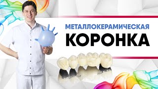 Металлокерамическая #коронка на зуб. Плюсы и минусы. [ #металлокерамика / #цирконий / #имакс? ].