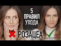 САМОЕ ВАЖНОЕ о розацеа || Главные правила ухода и лучшие средства