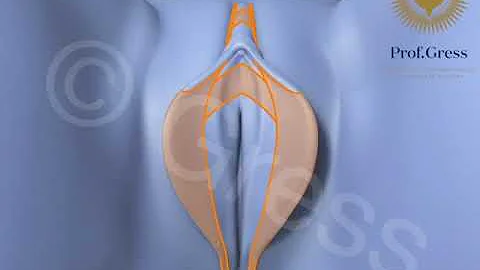 Composite Reduction Labiaplasty: Labia + Cltitoral Hood Reduction, correction of clitoral protrusion