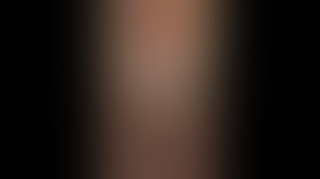 Red forest Psy dog encounter