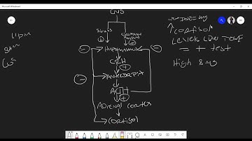 Understanding the Dexamethasone Suppression Test