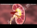 kidney expert: How to reduce the increased creatinine through a foot
bath