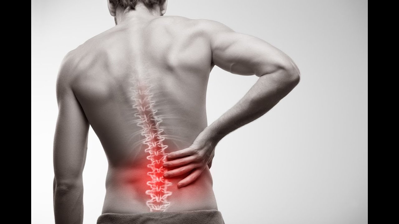 The Anatomy of Lower Back Pain, Low Back Pain