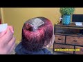 Baldness to Boldness: Striking Red Transformation on Salt and Pepper Hair - Alopecia Makeover!