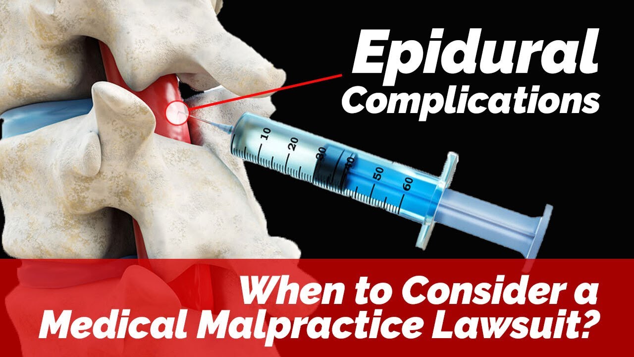 Epidural Complications- When to Consider a Medical Malpractice Lawsuit?