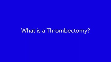 ESD Patient Pathway Thrombectomy Animation