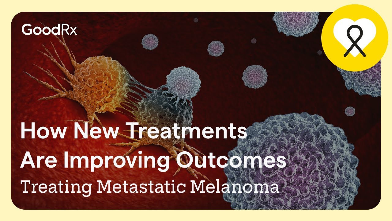 Metastatic Melanoma Treatment: What You Need to Know | GoodRx - YouTube