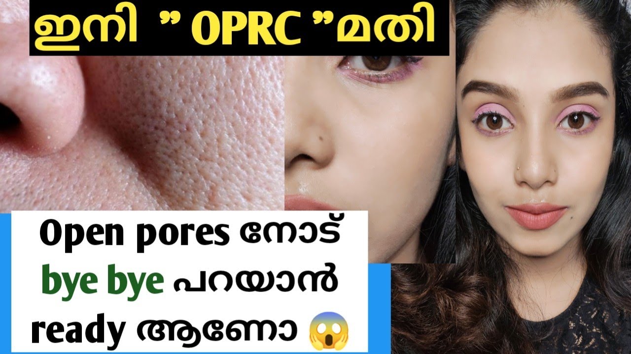 OPRC ഉണ്ടോ എങ്കിൽ OPEN PORES നോട് BYE BYE പറയാം | best homeremedy to removeopenpores naturallyathome