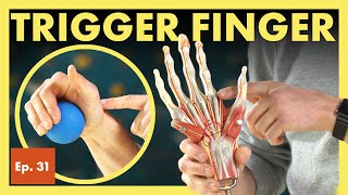 What is Trigger Finger and How Do I Fix It? (Stenosing Tenosynovitis)