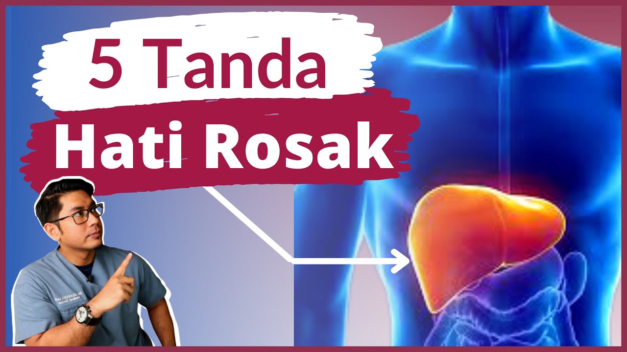 5 Tanda Hati Rosak | Liver Cirrhosis | Doctor Sani |