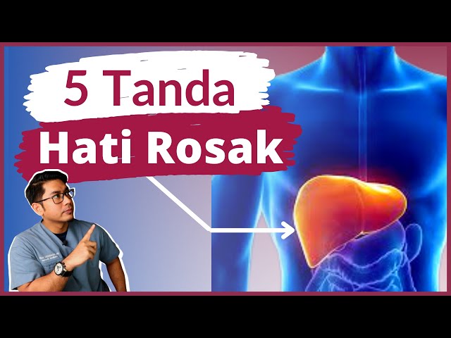 5 Tanda Hati Rosak | Liver Cirrhosis | Doctor Sani | class=