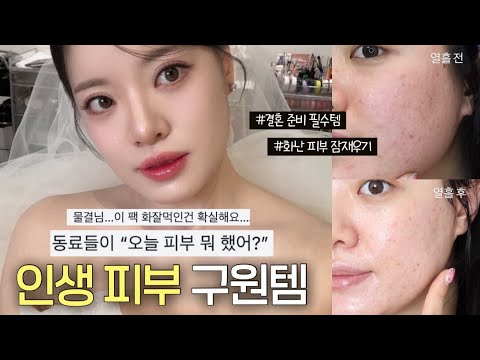 거울 보면 슬펐어요🥺 초민감 피부가 결혼할 때 쓴 홈케어 관리템 추천 | 떼루아본 마스크팩 마켓 공지 