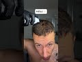 MIRAJ : La crème anti calvitie👌
