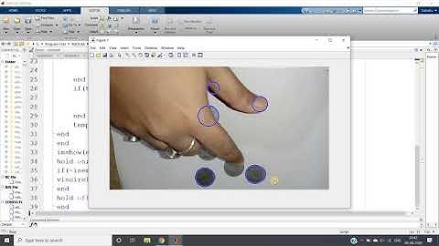 Detect nonoverlapping coins using Hough Transform | MATLAB