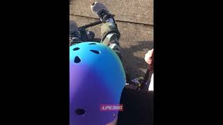Boy falls after losing control of hoverboard