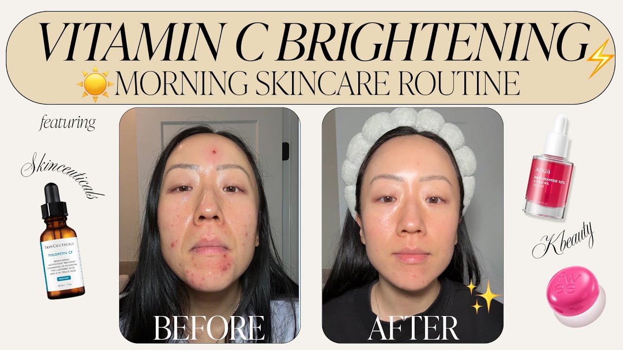 ⚡ Vitamin C Brightening Morning Skincare Routine for fading acne marks ...