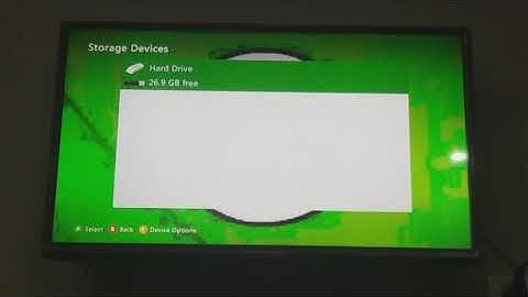 How To Delete XBOX 360 Profiles In Easy Way