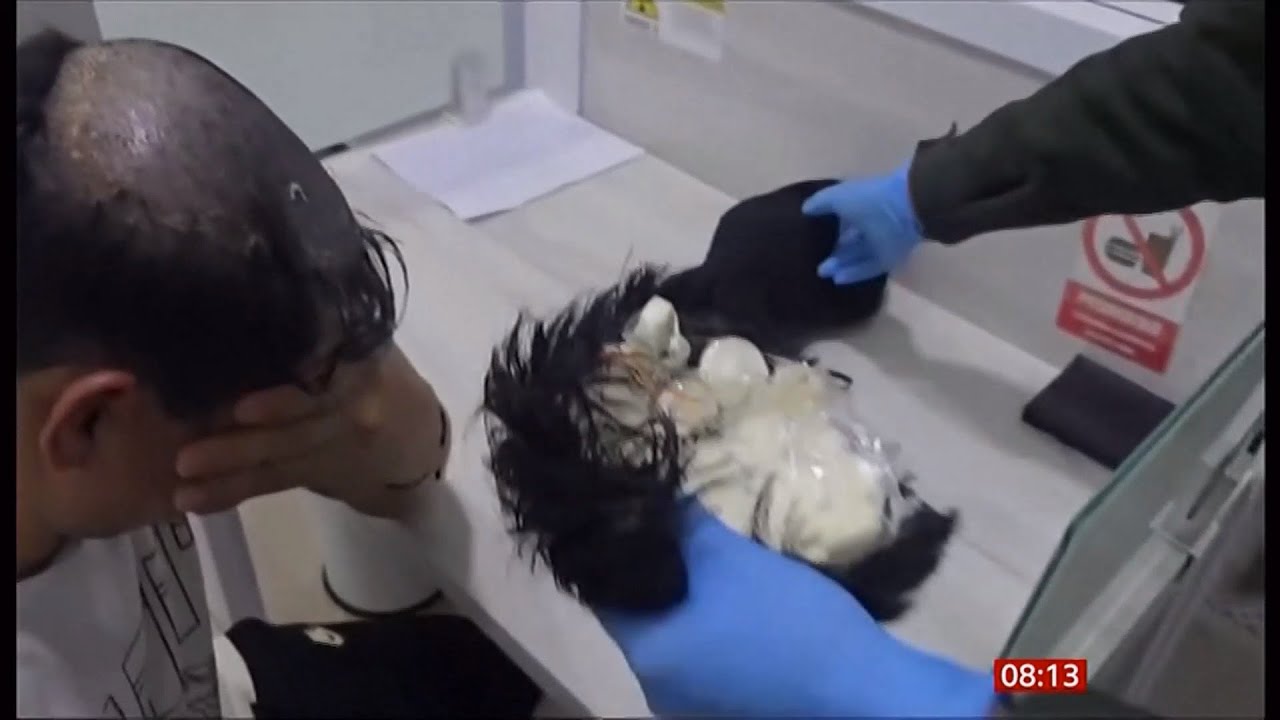 Man arrested trying to smuggle cocaine under toupee (Colombia) 25/Feb ...