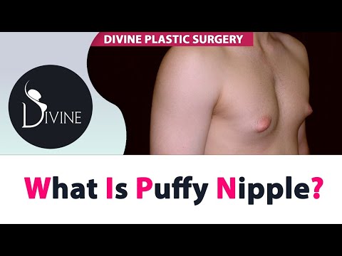 What is Puffy Nipple in Gynecomastia?