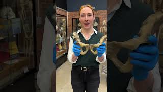 Exploring a pelvis fracture ￼