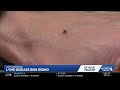 Lyme disease cases rise in Pennsylvania, local officials urge precaution