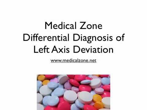 medical-zone---differential-diagnosis-of-left-axis-deviation