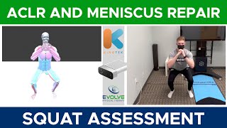 Anterior Cruciate Ligament Reconstruction And Meniscus Repair Squat Assessment