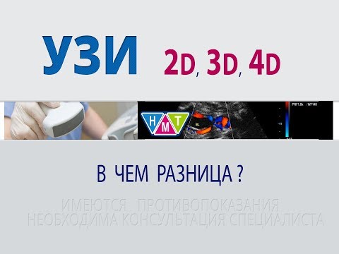 Видео: Разница между 3D и 4D УЗИ