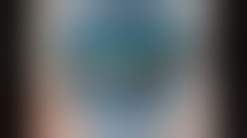 Trans Conjunctival SICS wound complication (deep dissection) -Management