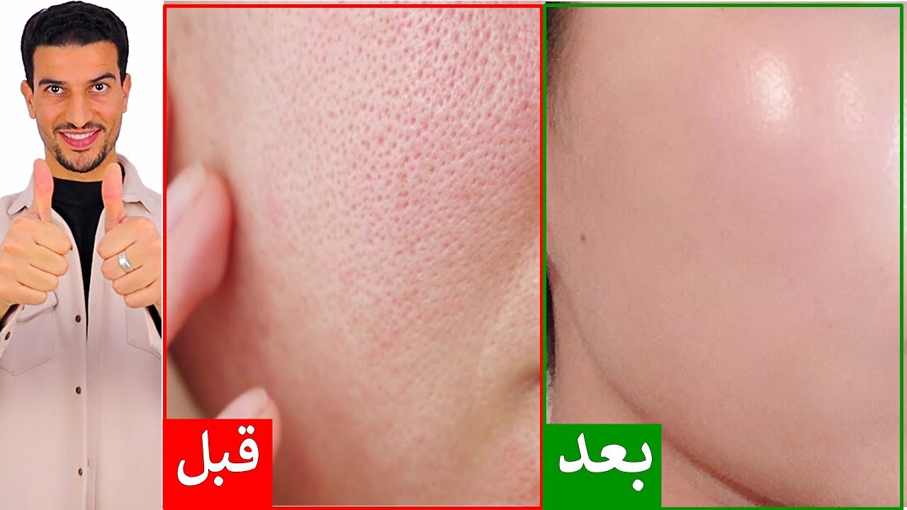 اسرع طريقة لتلميع وشد البشرة والتخلص من المسام الواسعة 👌
