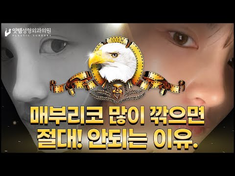 🙋‍♀:매부리코 많이 깎아 주세요!! 👨‍⚕:안 돼요.