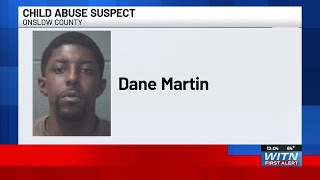 WARRANT: Onslow County stepfather fractures teen’s jaw